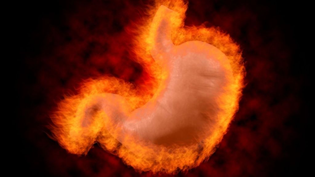 ACIDEZ Y REFLUJO              CAUSAS Y&nbsp;TRATAMIENTO